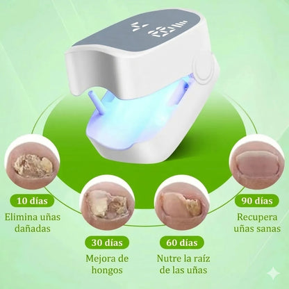 Láser para reparación de uñas | NailClear™